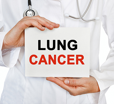 JAK Inhibitors for Lung Cancer - A Pipeline Analysis Report